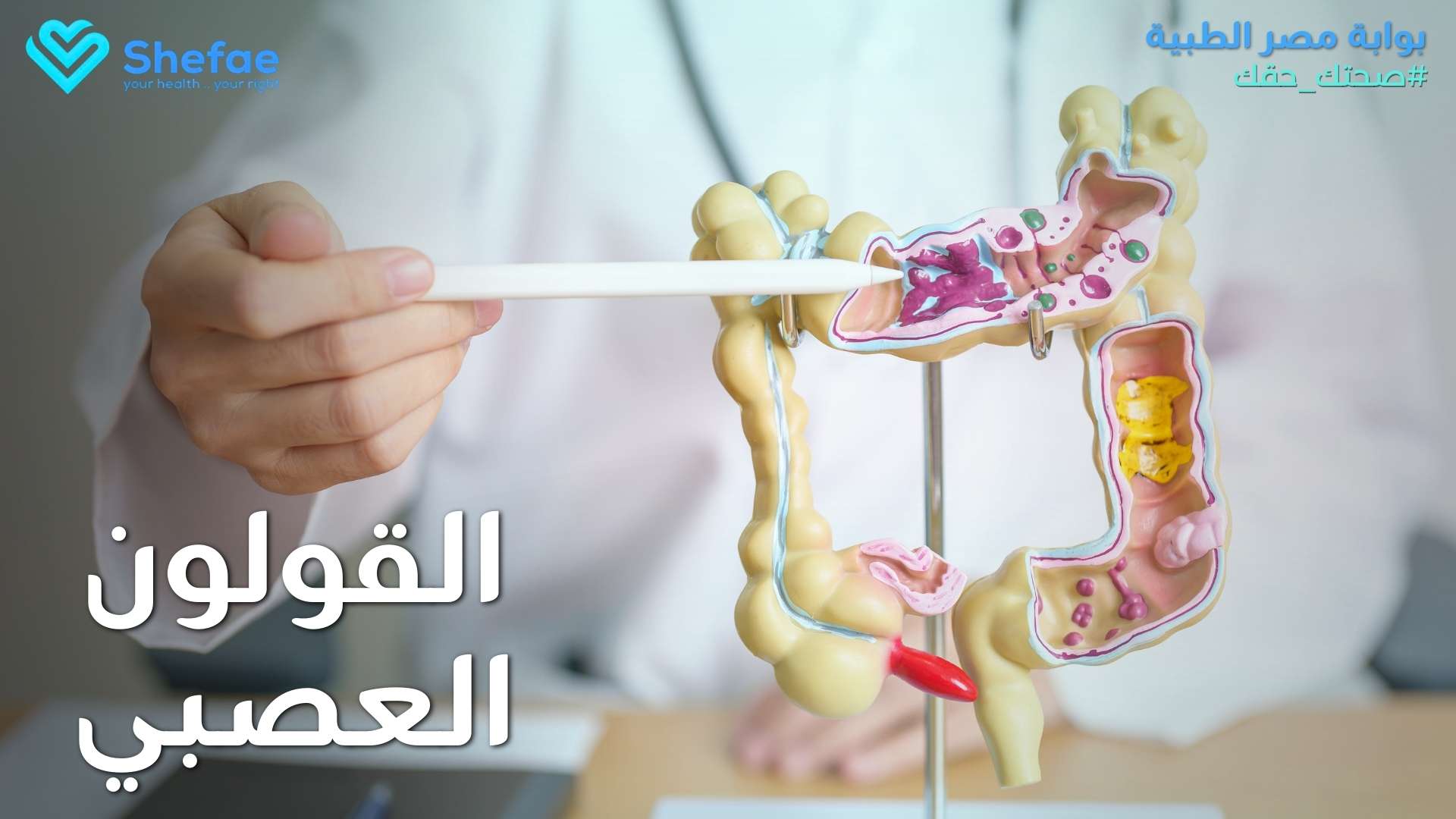 علاج القولون العصبي بطرق طبيعية وطبية