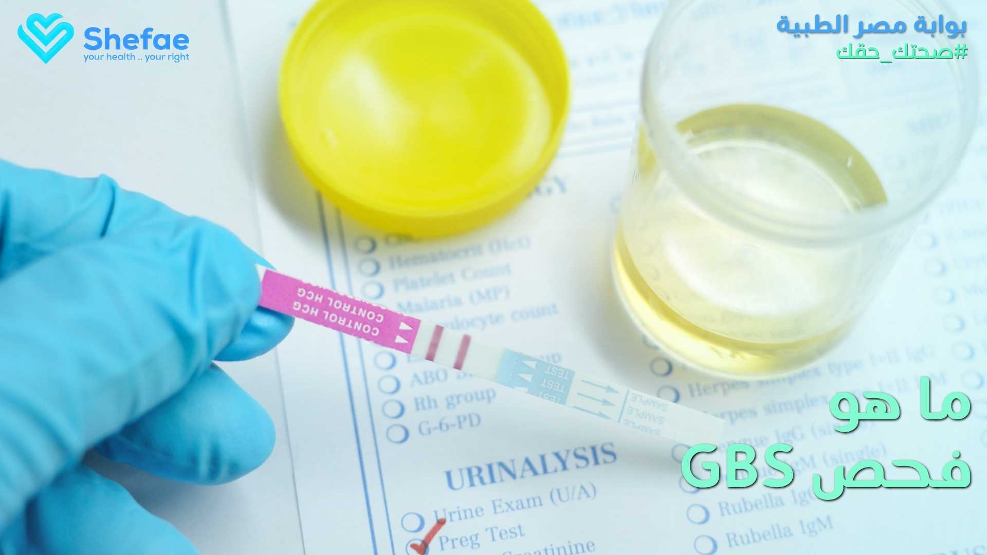 فحص GBS في الأسبوع 35–37: ماذا يعني وكيف يُتعامل معه؟