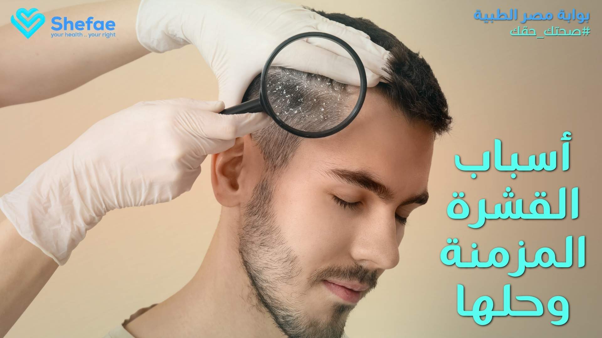 أسباب قشرة الشعر وطرق التخلص منها