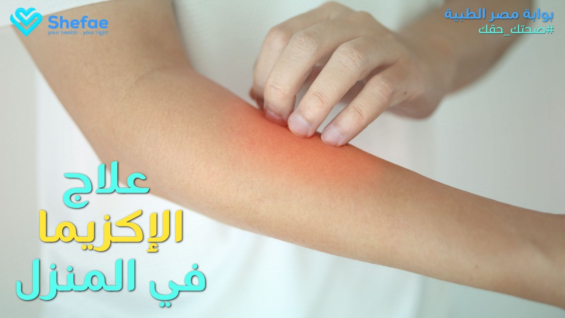 أعراض الإكزيما وطرق العلاج